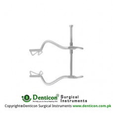 Gosset Retractor Stainless Steel, 18.5 cm - 7 1/4" Spread - Lateral Blade Size 140 mm - 63 x 35 mm